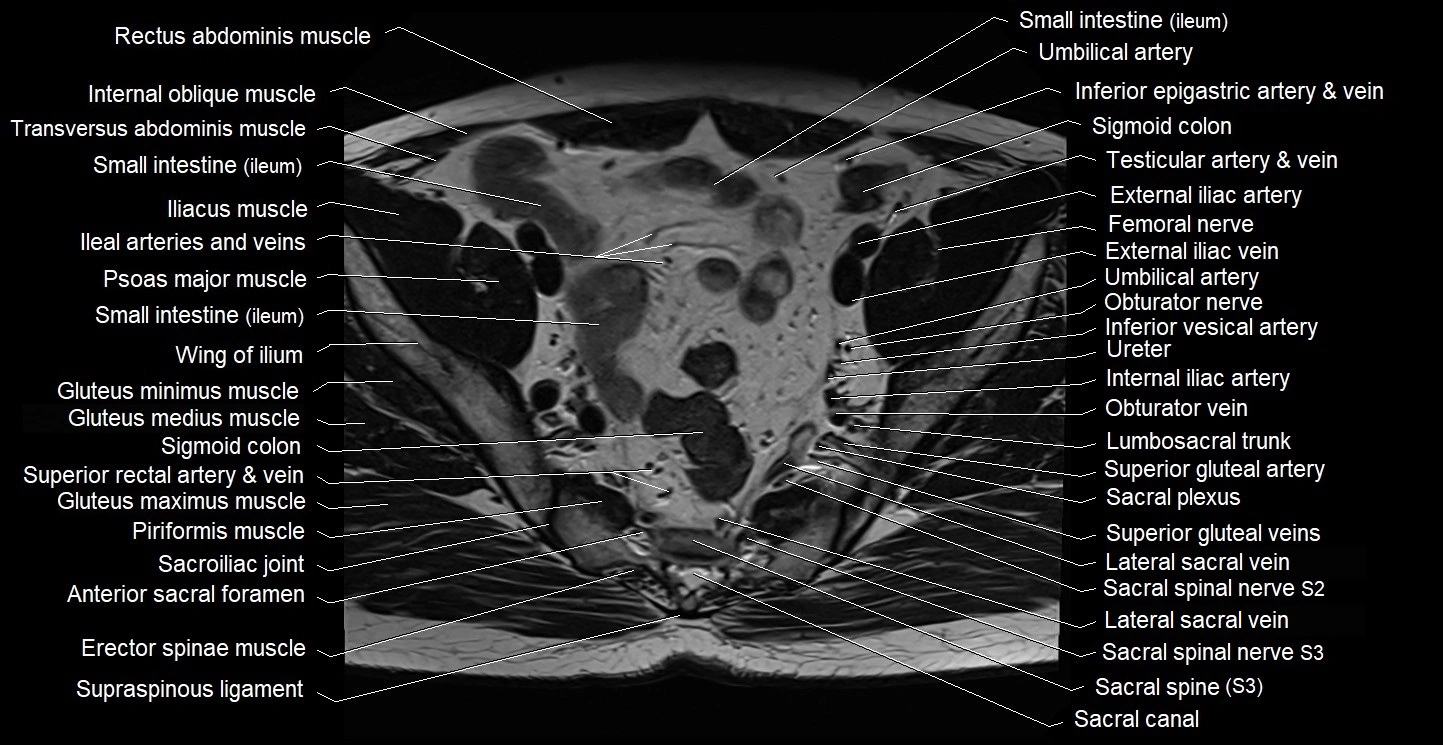 Male pelvis axial cross sectional anatomy image 12.webp